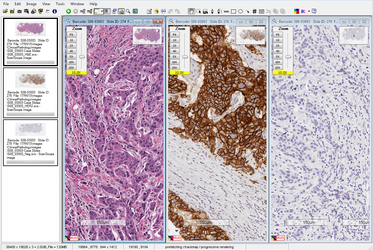 Интерфейс Aperio ImageScope