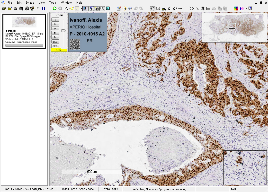 Интерфейс Aperio ImageScope