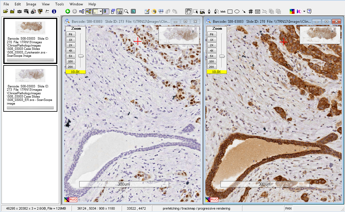 Интерфейс Aperio ImageScope