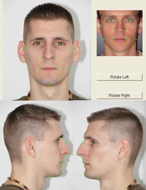 Контрольные точки на фронтальном и профильных снимках PhotoFit