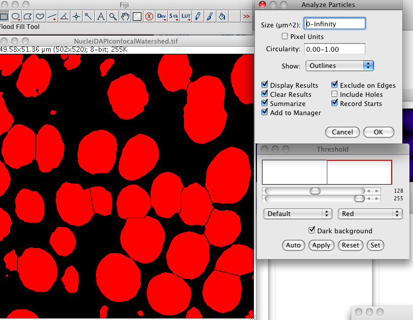 Окна Threshold и Analyze Particles в ImageJ при подсчете ядер после сегментации