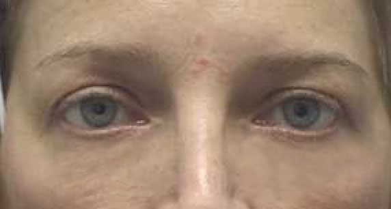 GIMP: урок по удалению мешков под глазами